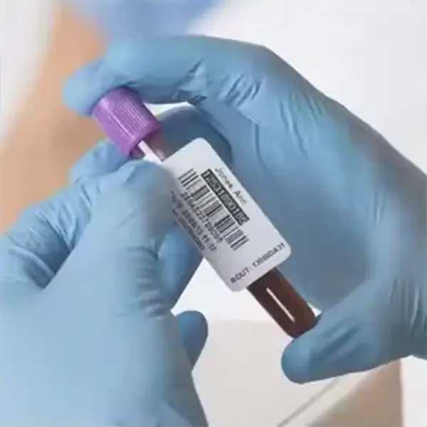 aggressive microtube adhesion