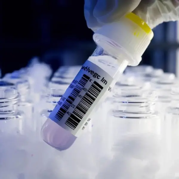 ultra low temperature resistant cryogenic